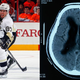 Image for article titled Return Of NHL Season Reignites Exciting Sidney Crosby Vs. Cranial Fluid Buildup Rivalry